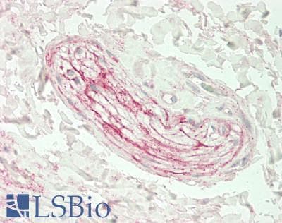 PathPlus™ Polyclonal Rabbit anti-Human TNC / Tenascin C Antibody (aa 1888-2201, IHC)