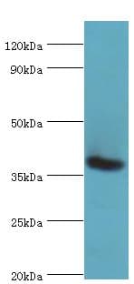 RD / PHYH Antibody (aa1-338)