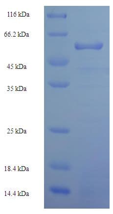Human MS / MTR Protein (Recombinant His-SUMO)