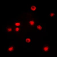 CEBPZ / CBF Antibody (N-Terminus)