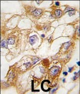 RGS19 Antibody (Ser24, aa 9-39)