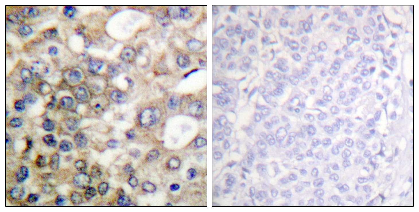 BTK Antibody (aa188-237)