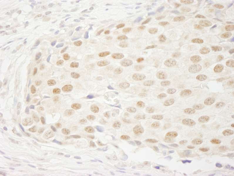 FBXW7 / FBW7 Antibody (aa50-100)