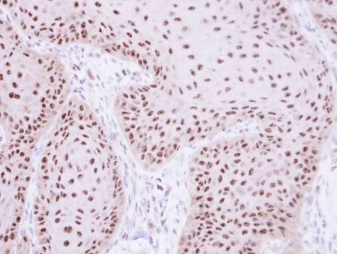 Polyclonal Rabbit anti-Human RPA70 / RPA1 Antibody (aa369-616, IHC, WB)