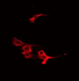 VASP Antibody (phospho-Ser239)