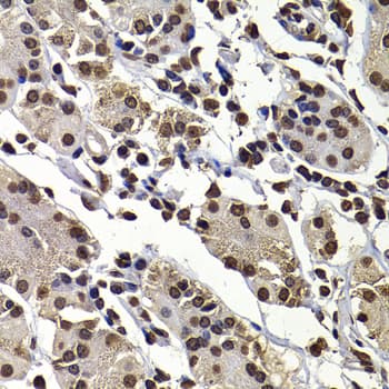 Polyclonal Rabbit anti-Human DNAJB6 Antibody (IHC, IF, WB)