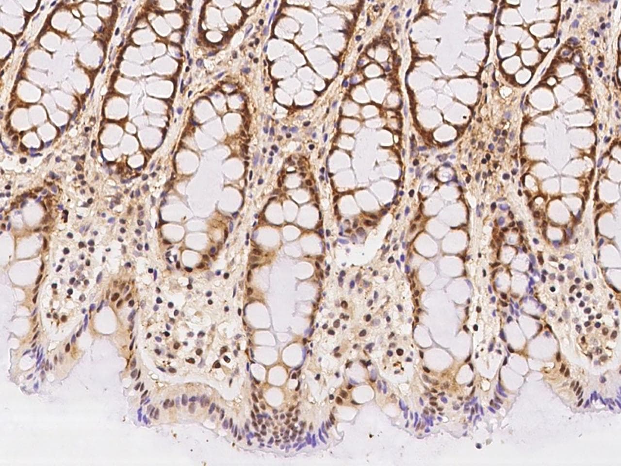 NR5A2 / LRH-1 Antibody