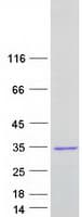 Human FGFR1OP2 Protein (Recombinant Myc-DDK (Flag))