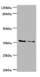 Polyclonal Rabbit anti-Human HOXA1 Antibody (aa75-205, IHC, WB)