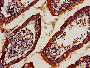 T-cell receptor beta-chain V region, clone WBDM28A Antibody