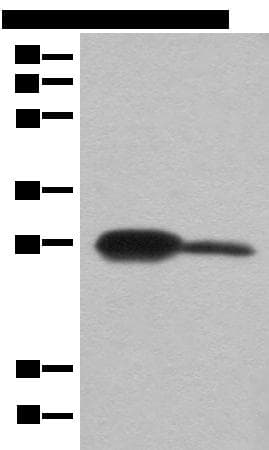 Polyclonal Rabbit anti-Human BDH2 Antibody (IHC, WB)