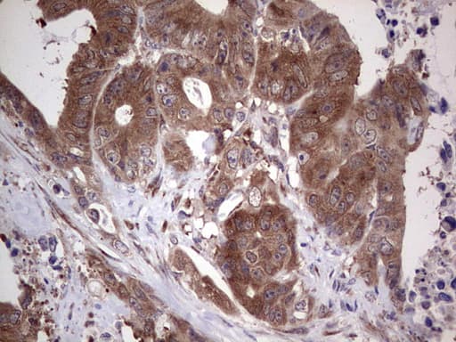Monoclonal Mouse anti-Human PIK3CA / PI3K Alpha Antibody (clone OTI8D6, aa303-631, IHC)