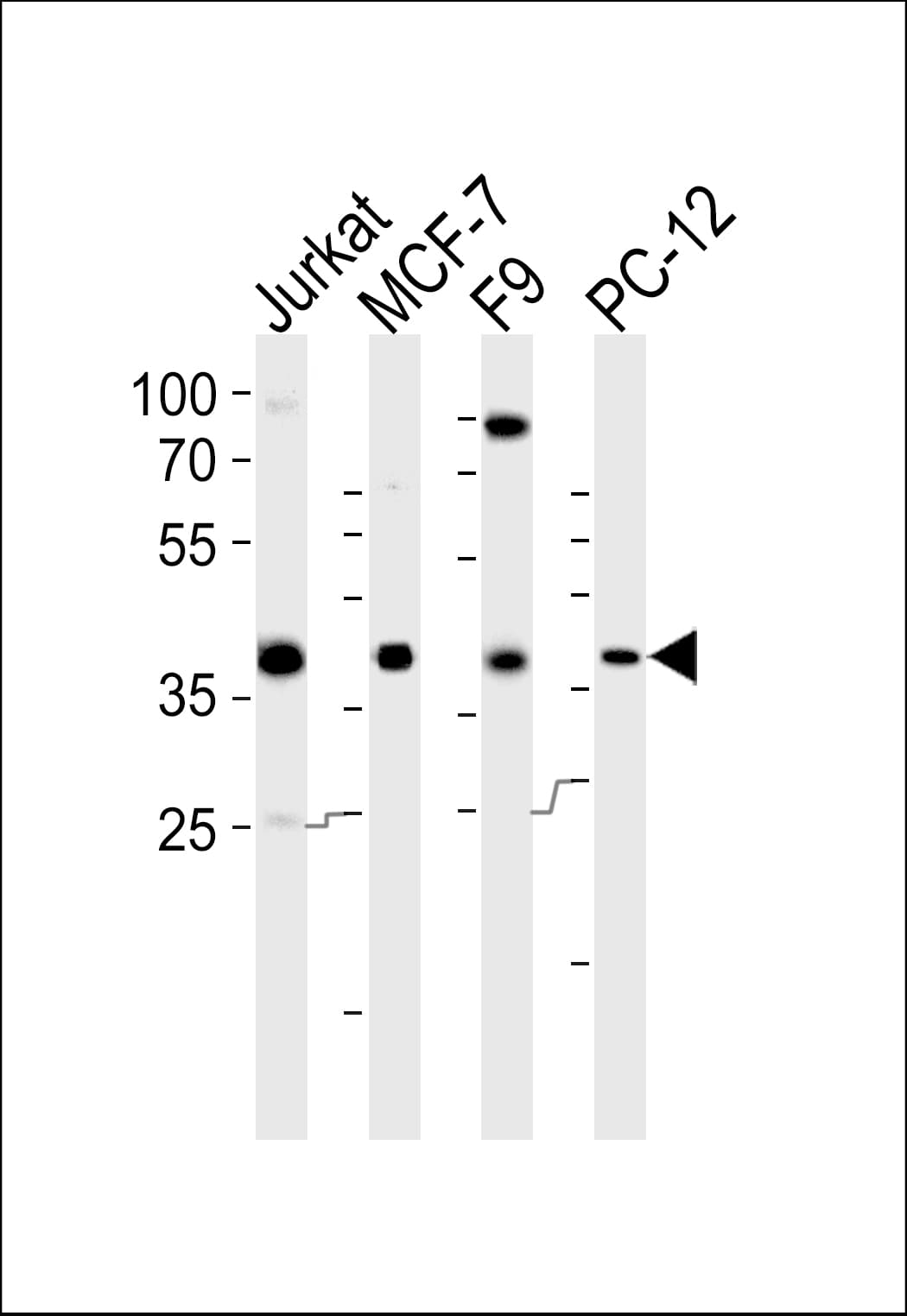 FOSL2 / FRA-2 Antibody (Tyr83)