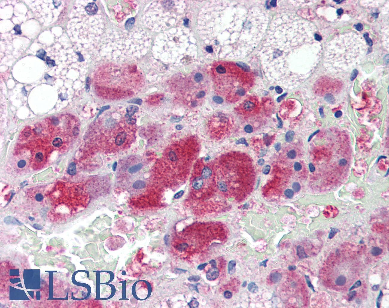 IHC-plus™ Calmodulin Antibody (aa1-149, clone J4D8)