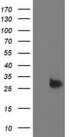 Thymidylate Kinase Antibody (clone OTI1C4)