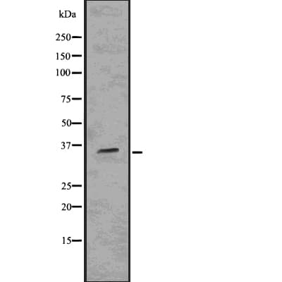 Polyclonal Rabbit anti-Human ITGAX / CD11c Antibody (IHC, WB)