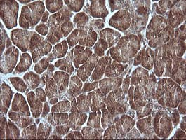 MAP2K1 / MKK1 / MEK1 Antibody (clone OTI3H5)