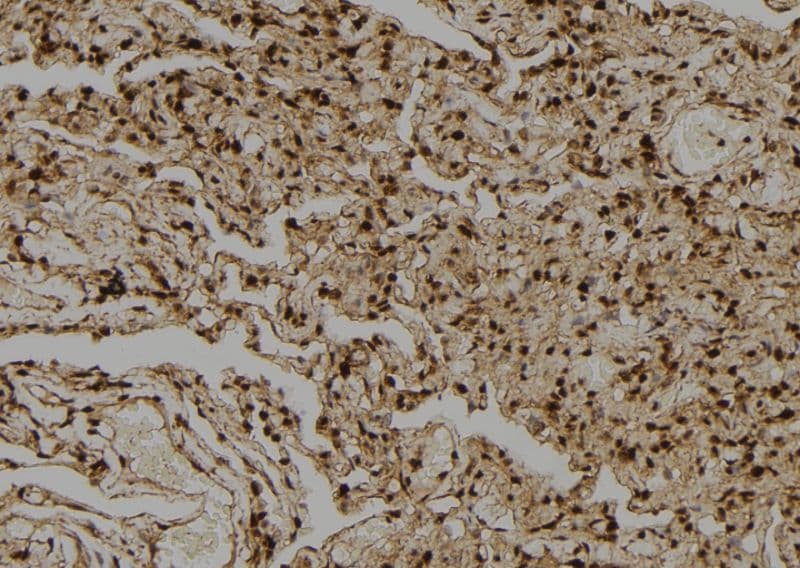 Polyclonal Rabbit anti-Human PPP1CA / PP1-Alpha Antibody (IHC, WB)