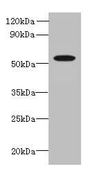 Polyclonal Rabbit anti-Human L2HGDH Antibody (IHC, WB)