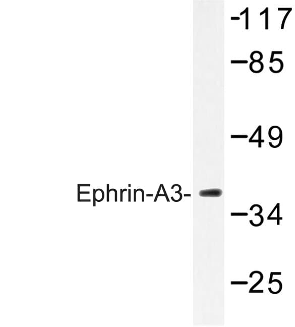 Polyclonal Rabbit anti-Human EFNA3 / Ephrin A3 Antibody (Glu196, IHC, IF, WB)