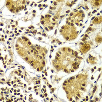 Polyclonal Rabbit anti-Human Aprataxin / APTX Antibody (IHC, IF, WB)