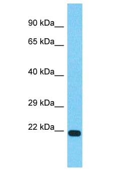 TVP23C Antibody (aa91-140)