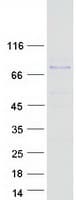 Human ZBTB7C Protein (Recombinant Myc-DDK (Flag))