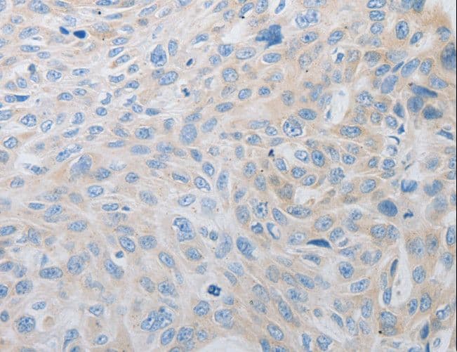 PDX1 Antibody