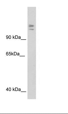 Polyclonal Rabbit anti-Mouse MYBBP1A Antibody (aa1201-1250, IHC, WB)