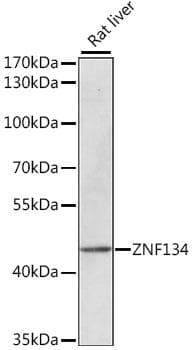 Polyclonal Rabbit anti-Human ZNF134 Antibody (WB)