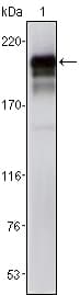 Monoclonal Mouse anti-Human PDGFRB / PDGFR Beta Antibody (clone 1A2, WB)