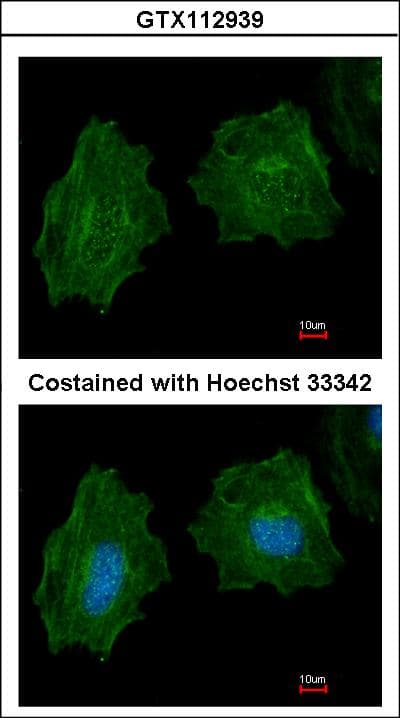 IHC-plus™ Polyclonal Rabbit anti-Human FLNA / Filamin A Antibody (IHC, IF, WB)