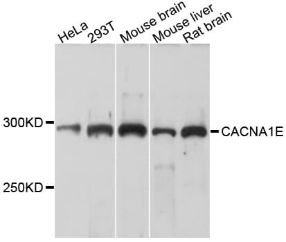IHC-plus™ Polyclonal Rabbit anti-Human CACNA1E / Cav2.3 Antibody (IHC, WB)