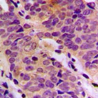 DDH / AKR1C1 Antibody (N-Terminus)