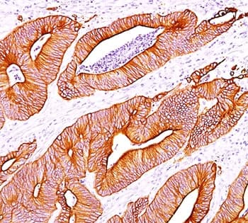 Cytokeratin AE1+AE3 Antibody (clone AE1+AE3)