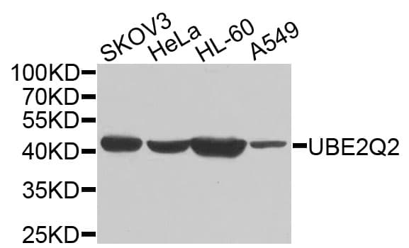 Polyclonal Rabbit anti-Human UBE2Q2 Antibody (WB)