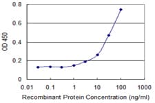 MUSK Antibody (clone 2H6)