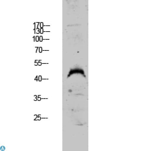 DUSP4 / MKP2 Antibody