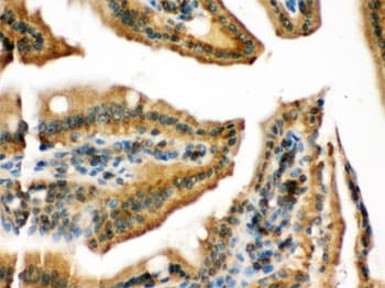 Polyclonal Rabbit anti-Human RAB13 Antibody (IHC, WB)