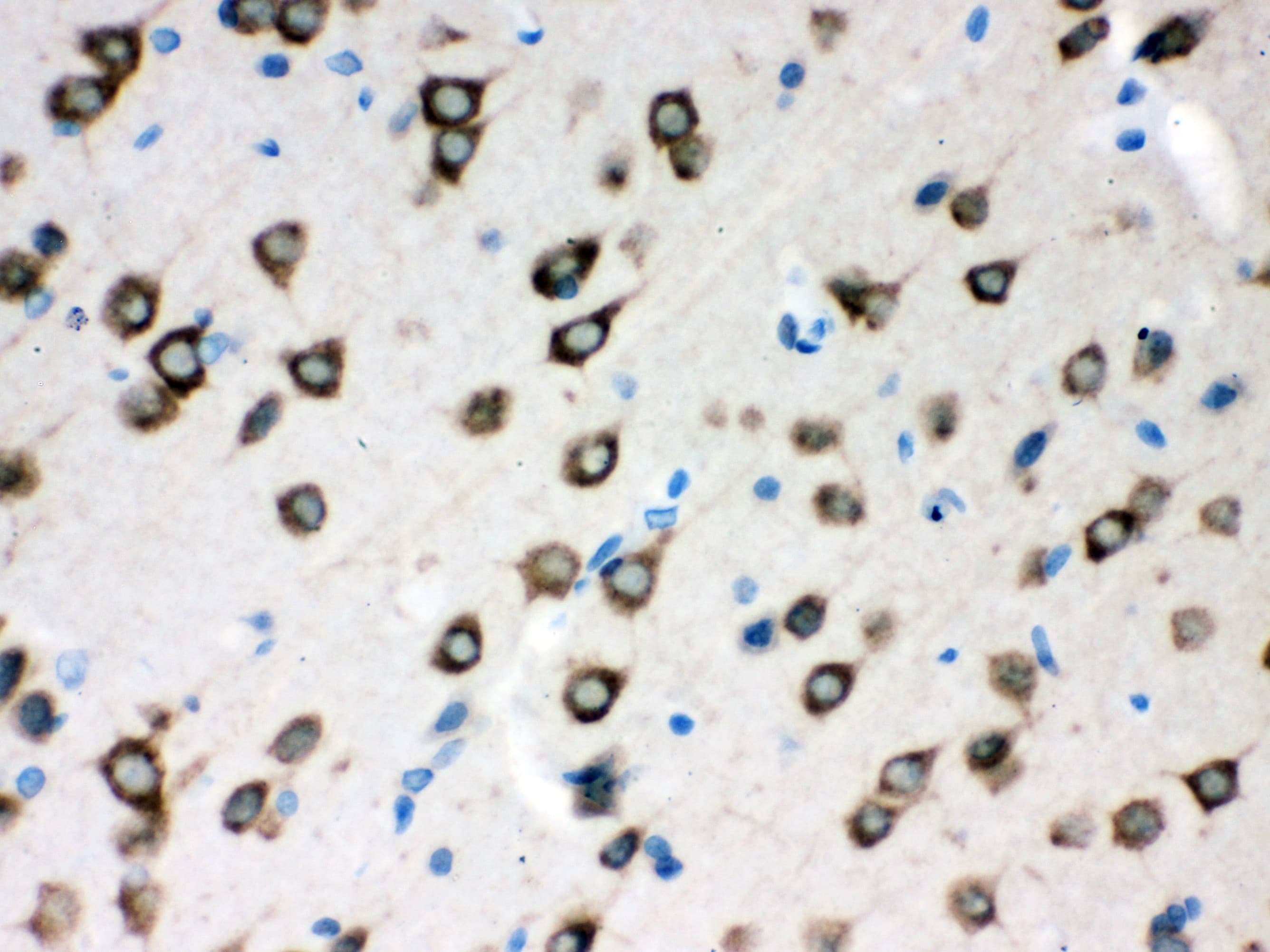 SMN1 Antibody (aa22-52)