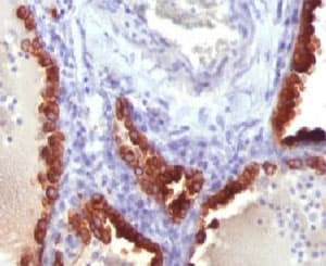 KRT7 / CK7 / Cytokeratin 7 Antibody (clone CTKN7-1)