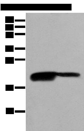 Polyclonal Rabbit anti-Human BRI3BP Antibody (IHC, WB)