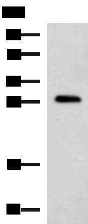 CMTM2 Antibody