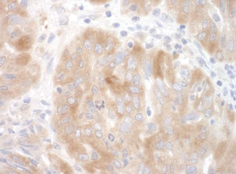 SRPK2 Antibody (aa425-475)