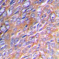 COL3A1 / Collagen III Antibody (N-Terminus)