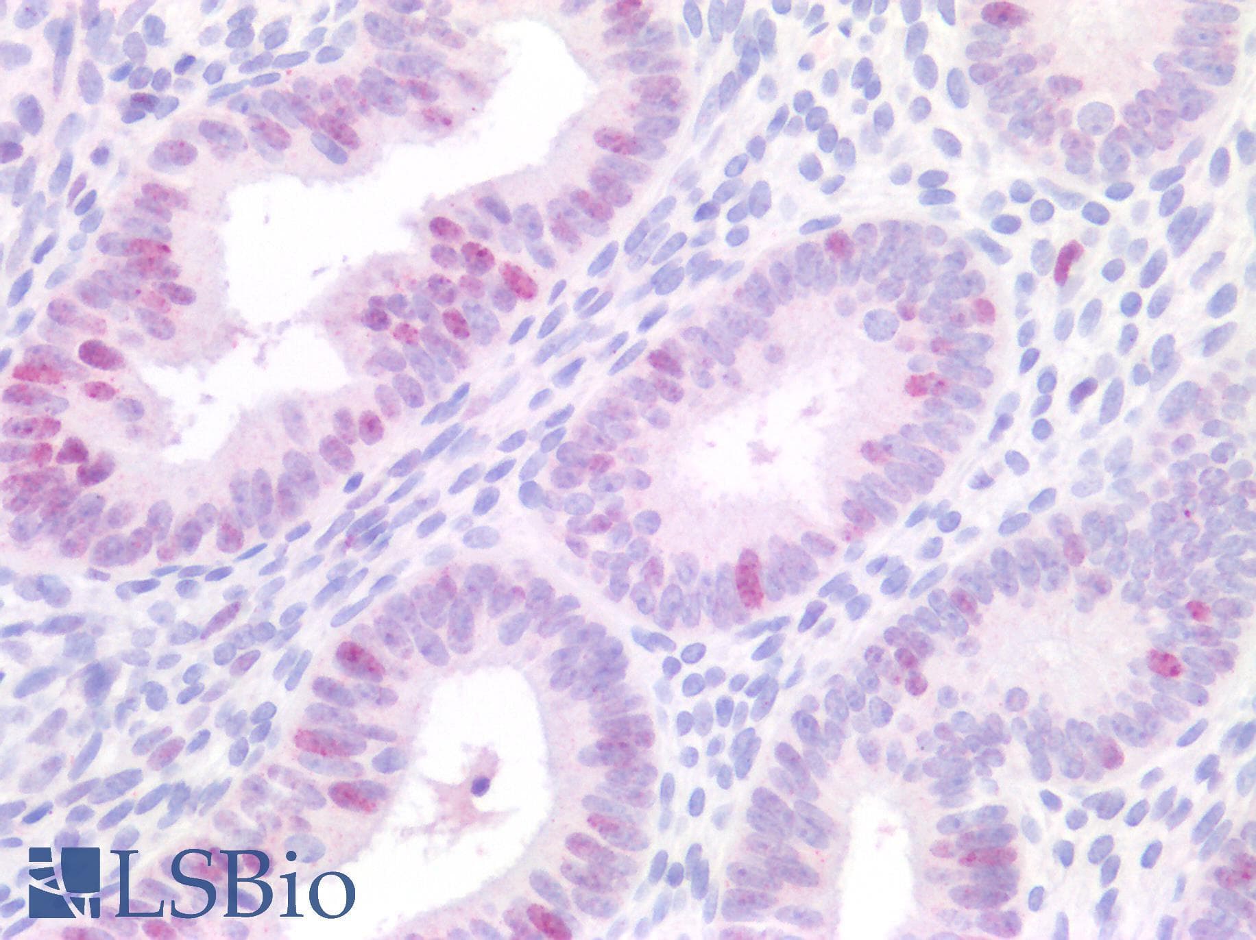 PathPlus™ MCM3 Antibody