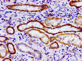 USP9X / FAM Antibody