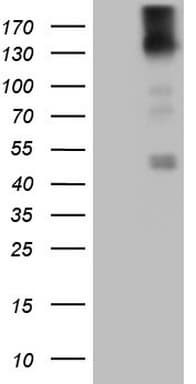 PDGFRA / PDGFR Alpha Antibody (aa789-1089, clone OTI1C10)