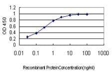 IHC-plus™ Monoclonal Mouse anti-Human GMEB1 Antibody (clone 2A8, IHC, IF, WB)