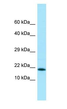 MMS2 / UBE2V2 Antibody (C-Terminus)